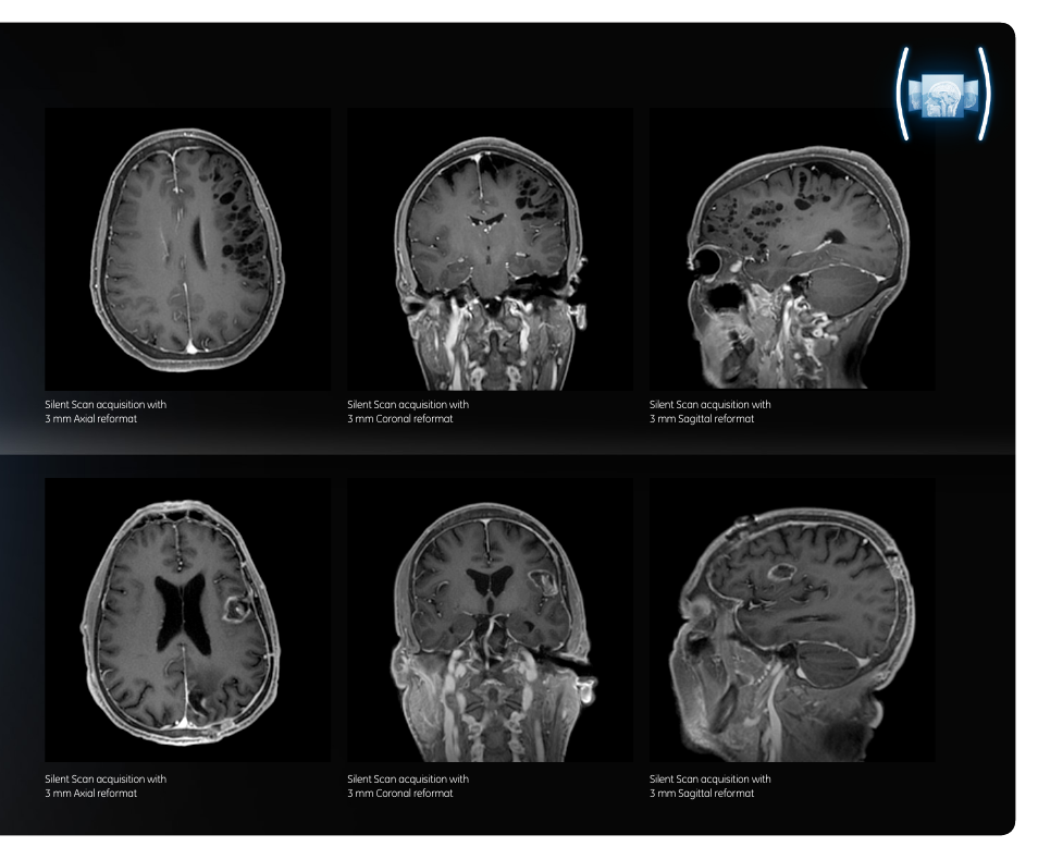 Sight of silence | GE Healthcare SILENT SCAN User Manual | Page 9 / 12
