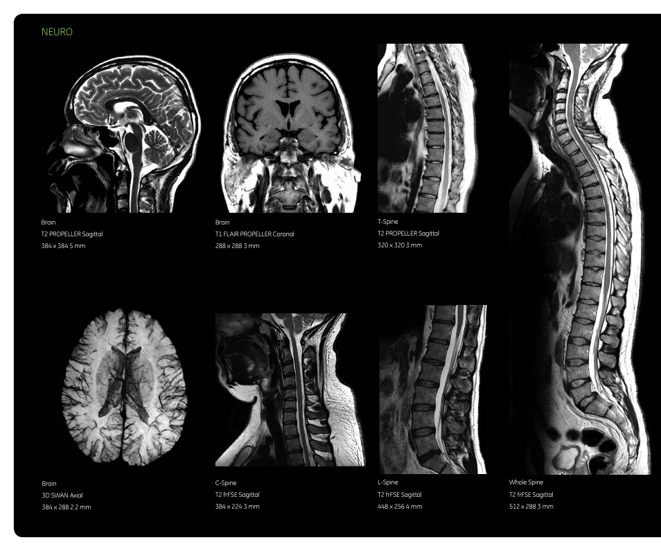 Neuro | GE Healthcare Optima MR450w 1.5T User Manual | Page 12 / 20
