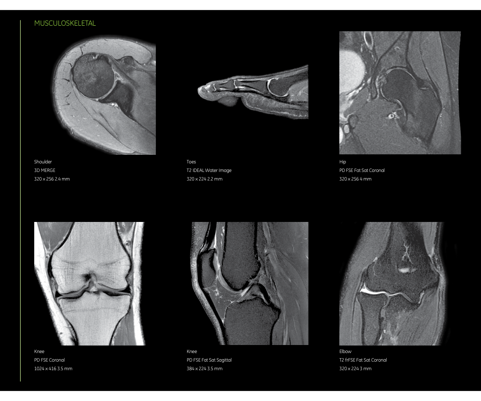 Musculoskeletal | GE Healthcare Optima MR450w 1.5T User Manual | Page 13 / 20