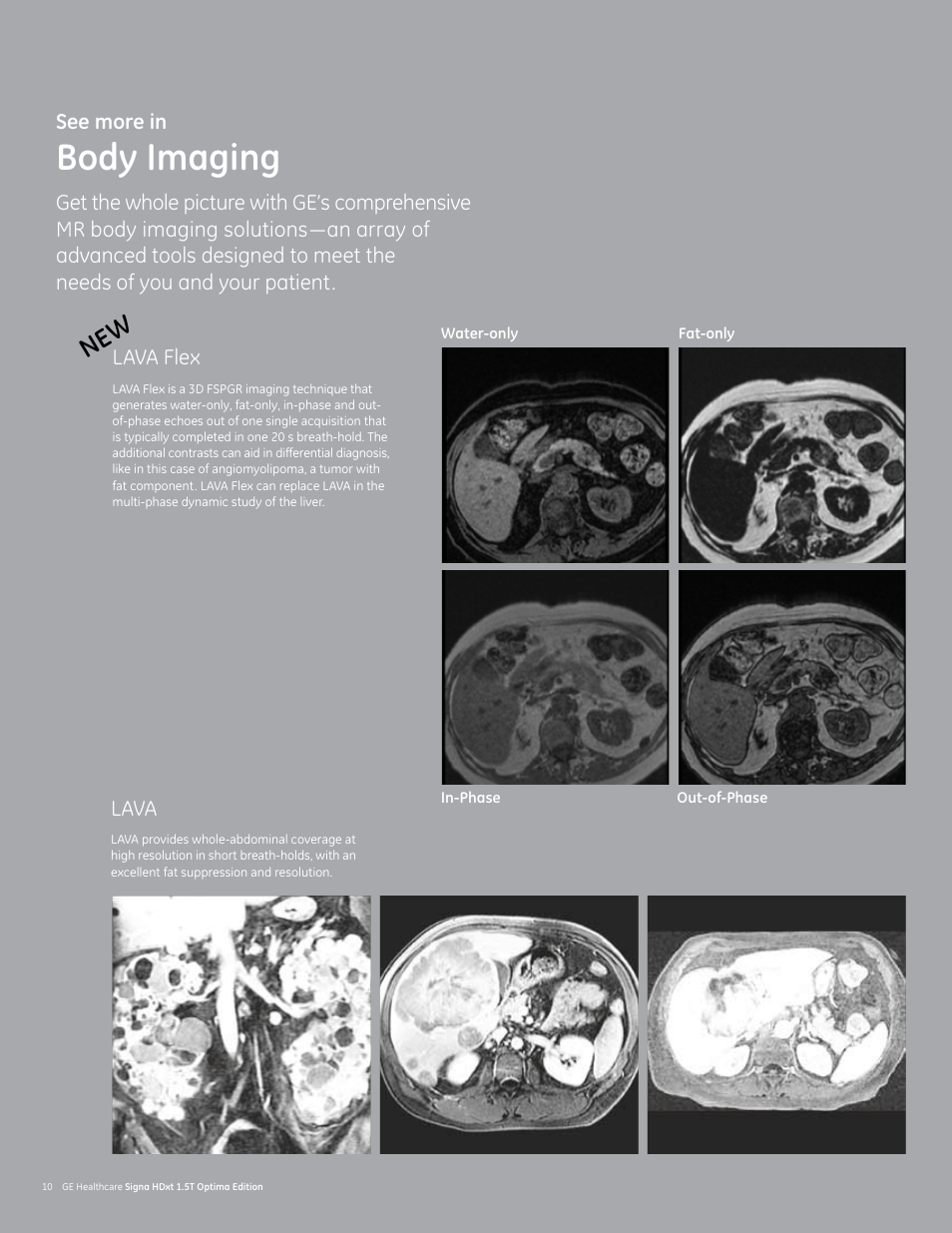 Body imaging, Ne w | GE Healthcare Signa HDxt 1.5T User Manual | Page 10 / 28