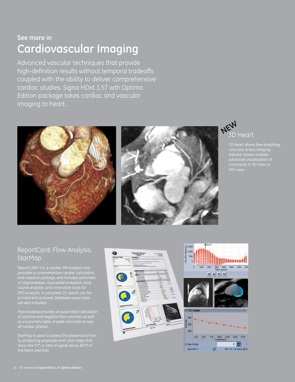 Cardiovascular imaging, Ne w | GE Healthcare Signa HDxt 1.5T User Manual | Page 16 / 28