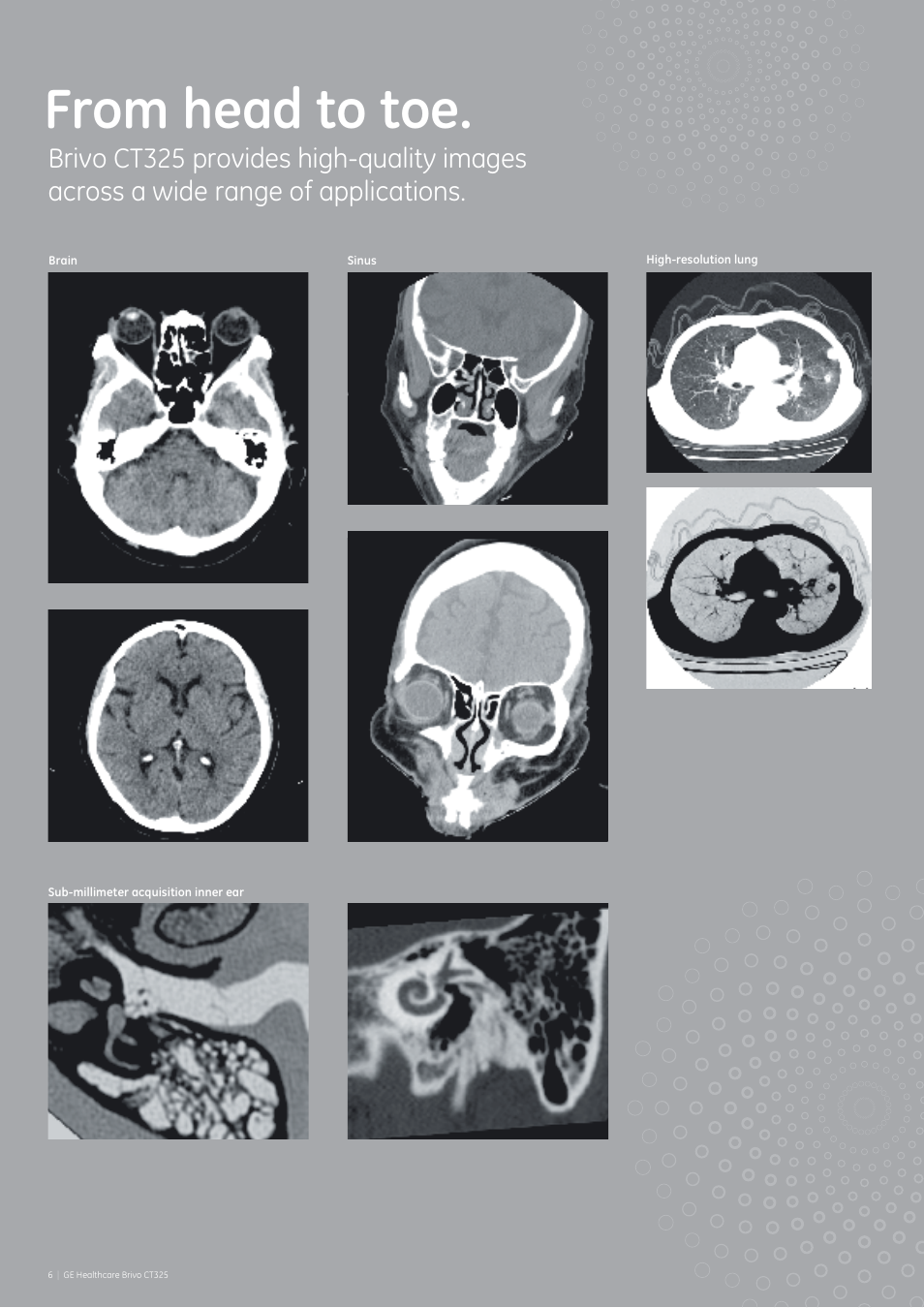 Clinical images | GE Healthcare Brivo CT325 User Manual | Page 6 / 12