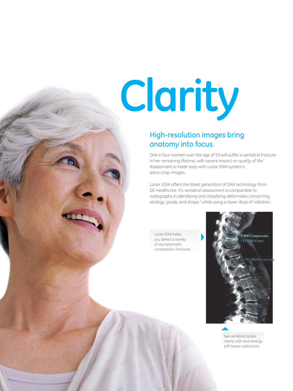 Clarity, High-resolution images bring anatomy into focus | GE Healthcare Lunar iDXA User Manual | Page 4 / 8