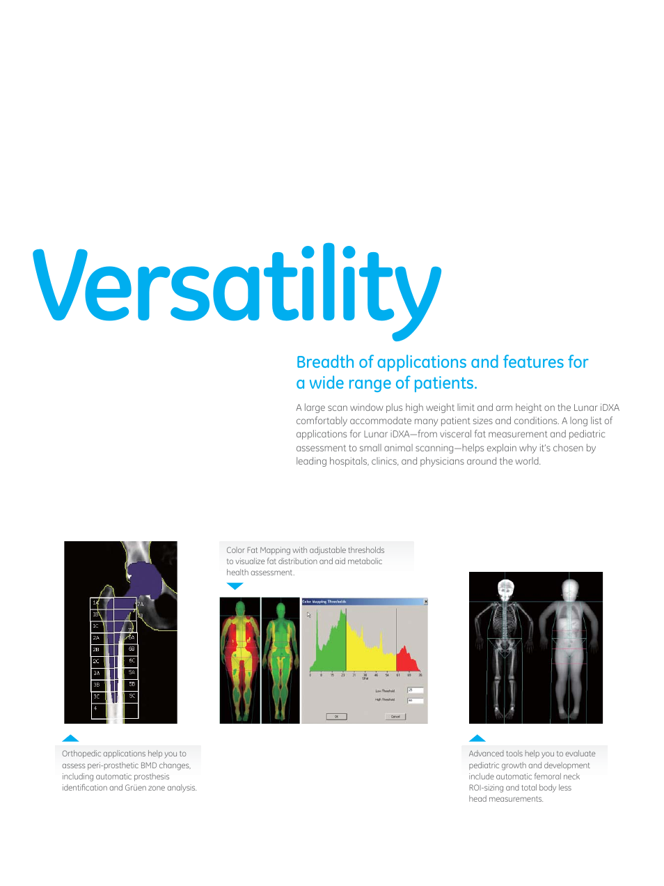Versatility | GE Healthcare Lunar iDXA User Manual | Page 6 / 8
