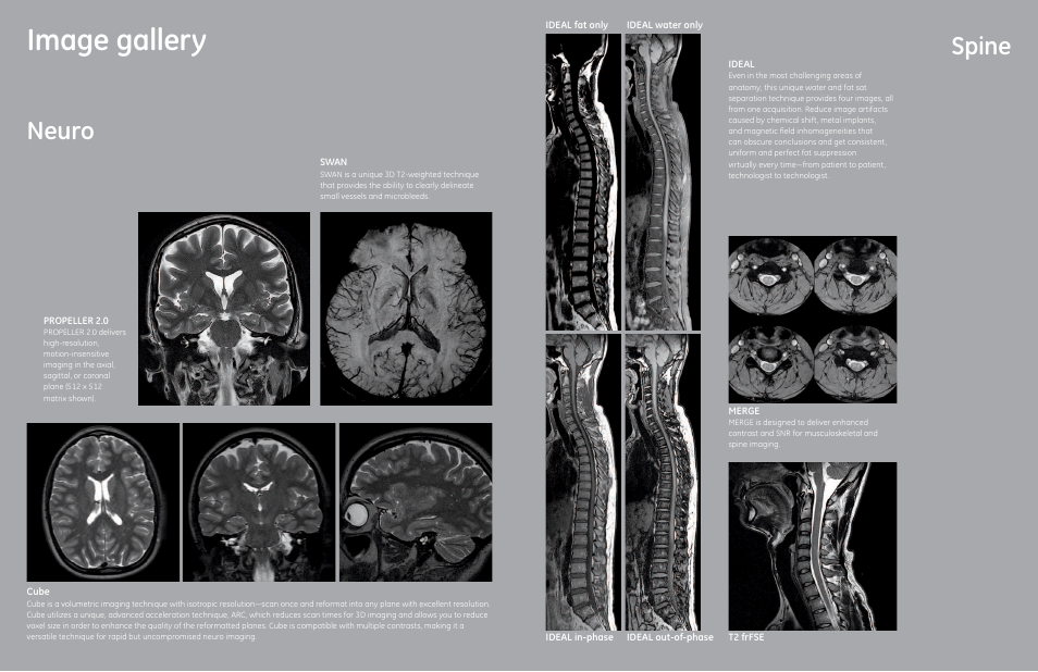 Image gallery, Neuro, Spine | GE Healthcare Optima MR360 1.5T User Manual | Page 6 / 9