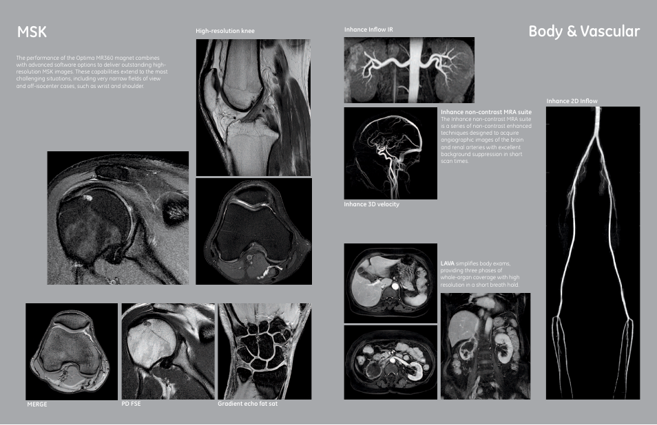 Body & vascular | GE Healthcare Optima MR360 1.5T User Manual | Page 7 / 9
