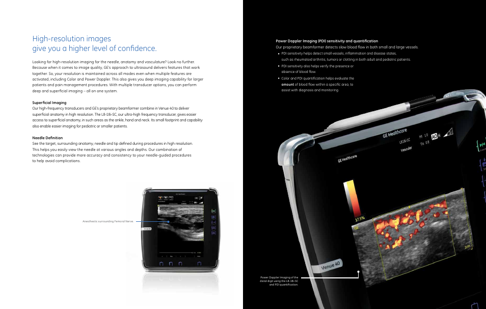 GE Healthcare Venue 40 User Manual | Page 4 / 9