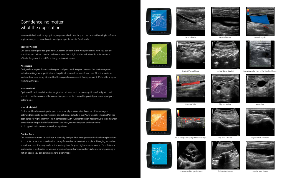 Confidence, no matter what the application | GE Healthcare Venue 40 User Manual | Page 7 / 9
