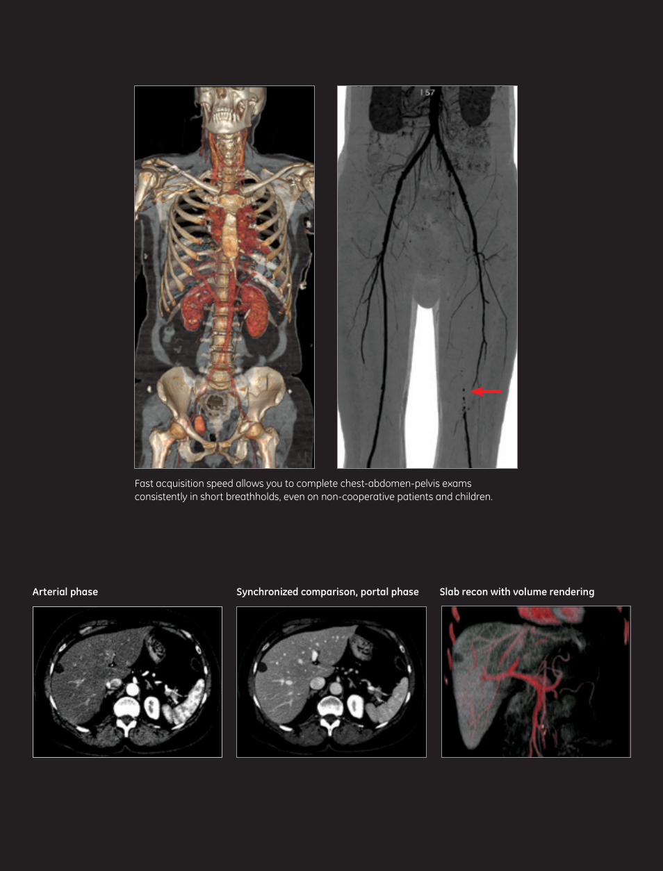 GE Healthcare Optima CT520 User Manual | Page 5 / 24