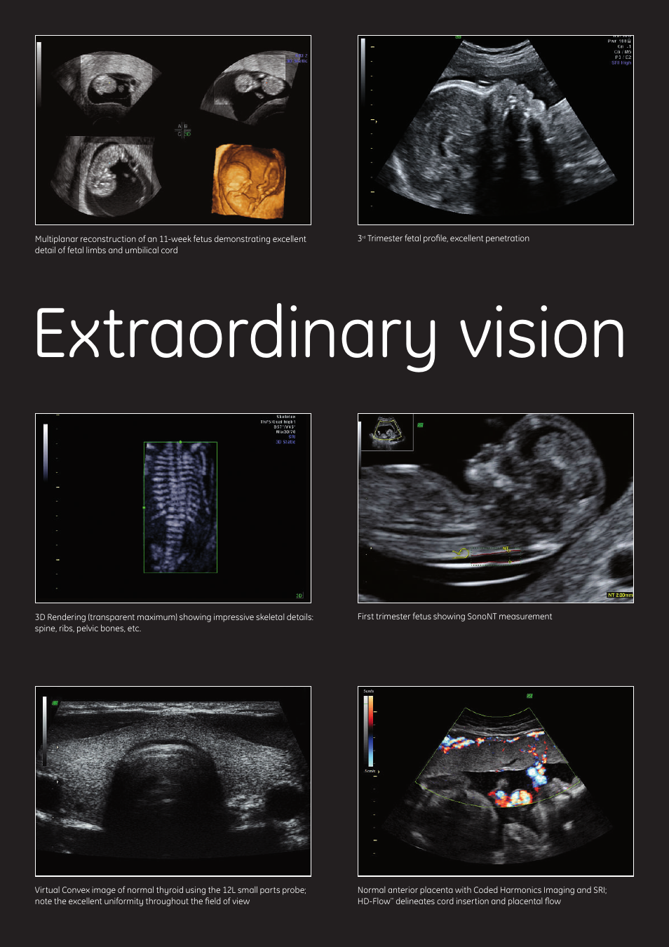 Extraordinary vision | GE Healthcare Voluson e User Manual | Page 4 / 8