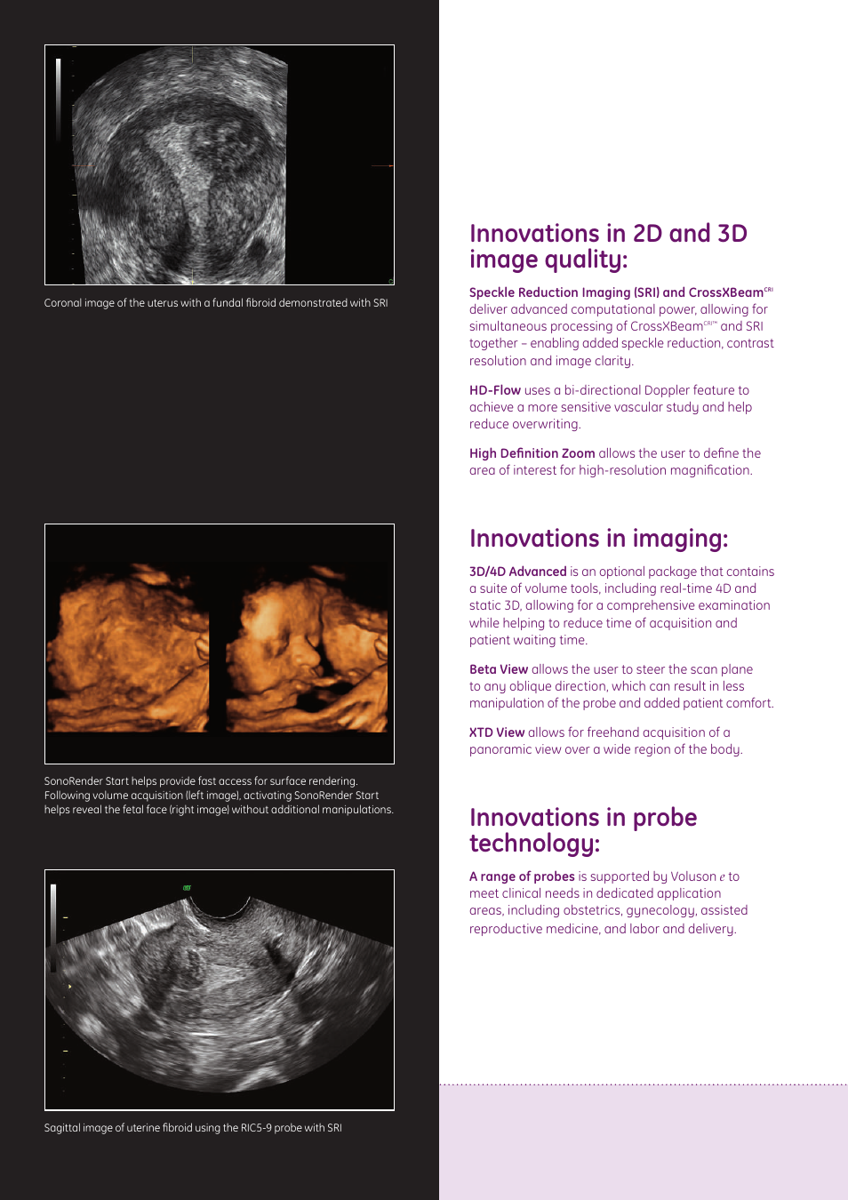Innovations in 2d and 3d image quality, Innovations in imaging, Innovations in probe technology | GE Healthcare Voluson e User Manual | Page 5 / 8