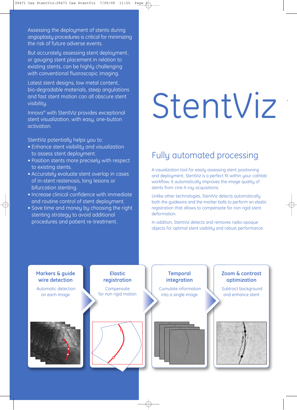 Stentviz t, Fully automated processing | GE Healthcare StentViz User Manual | Page 2 / 8