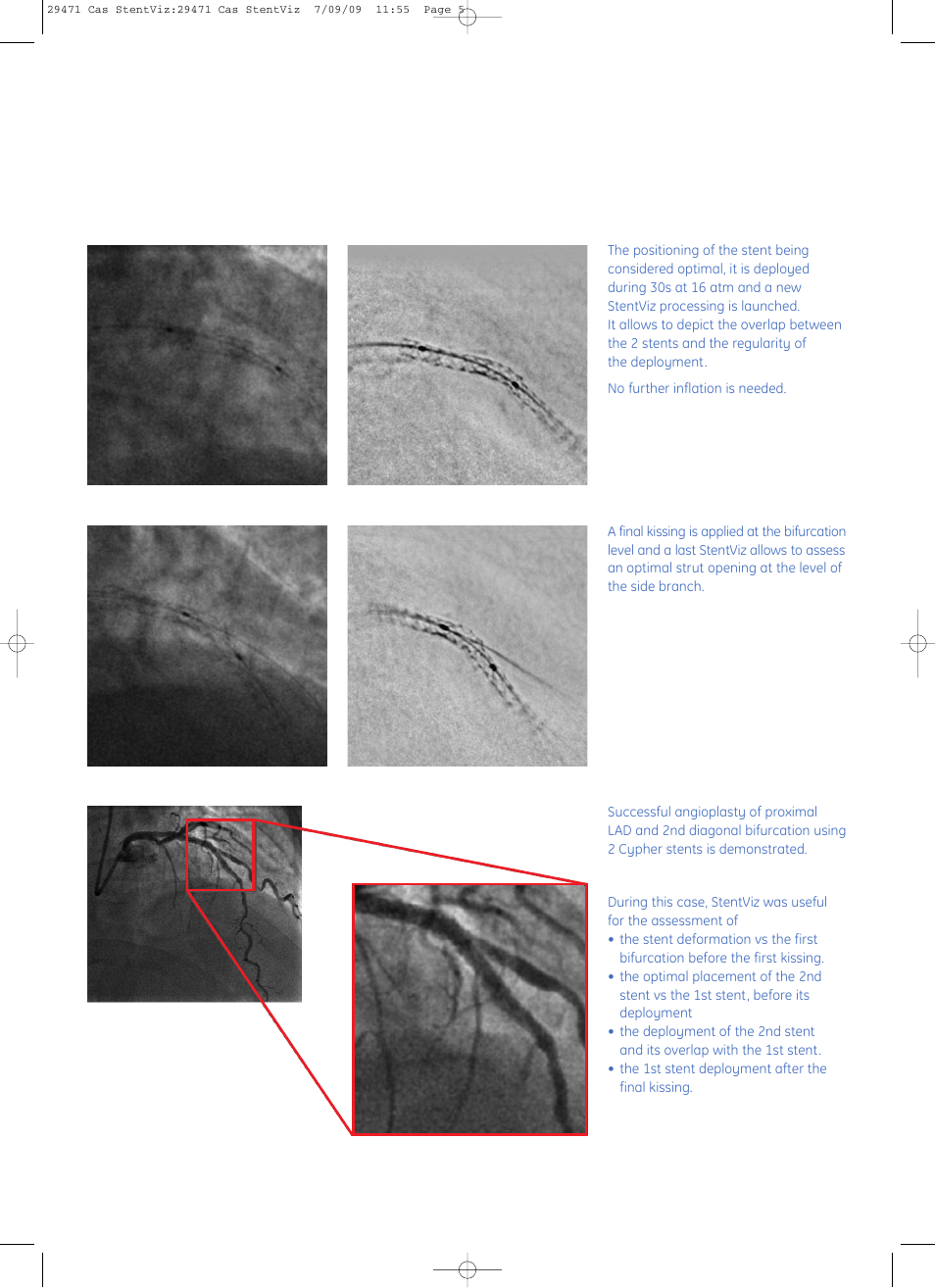 GE Healthcare StentViz User Manual | Page 5 / 8
