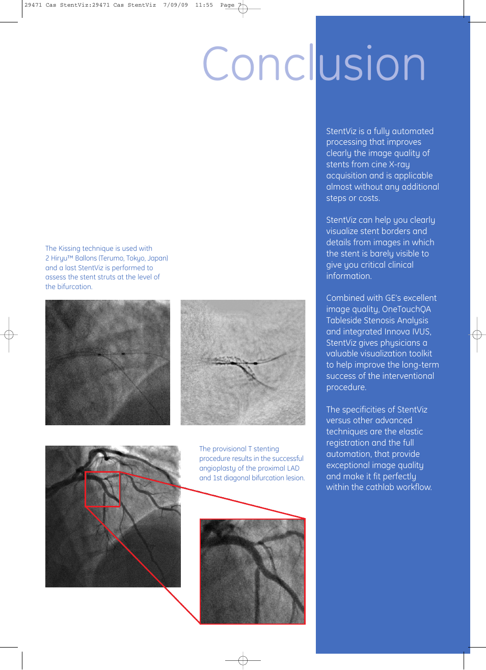 Conclusion | GE Healthcare StentViz User Manual | Page 7 / 8