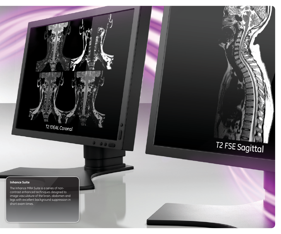 GE Healthcare Brivo MR355 1.5T Inspire User Manual | Page 11 / 18