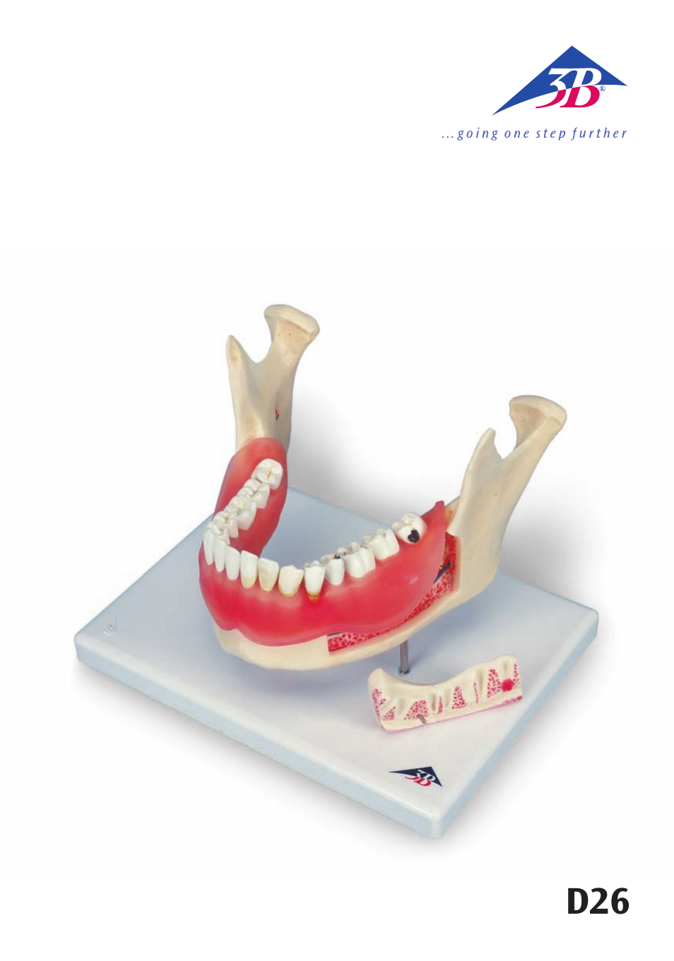 3B Scientific Dental disease, magnified 2 times, 21 parts User Manual | 16 pages