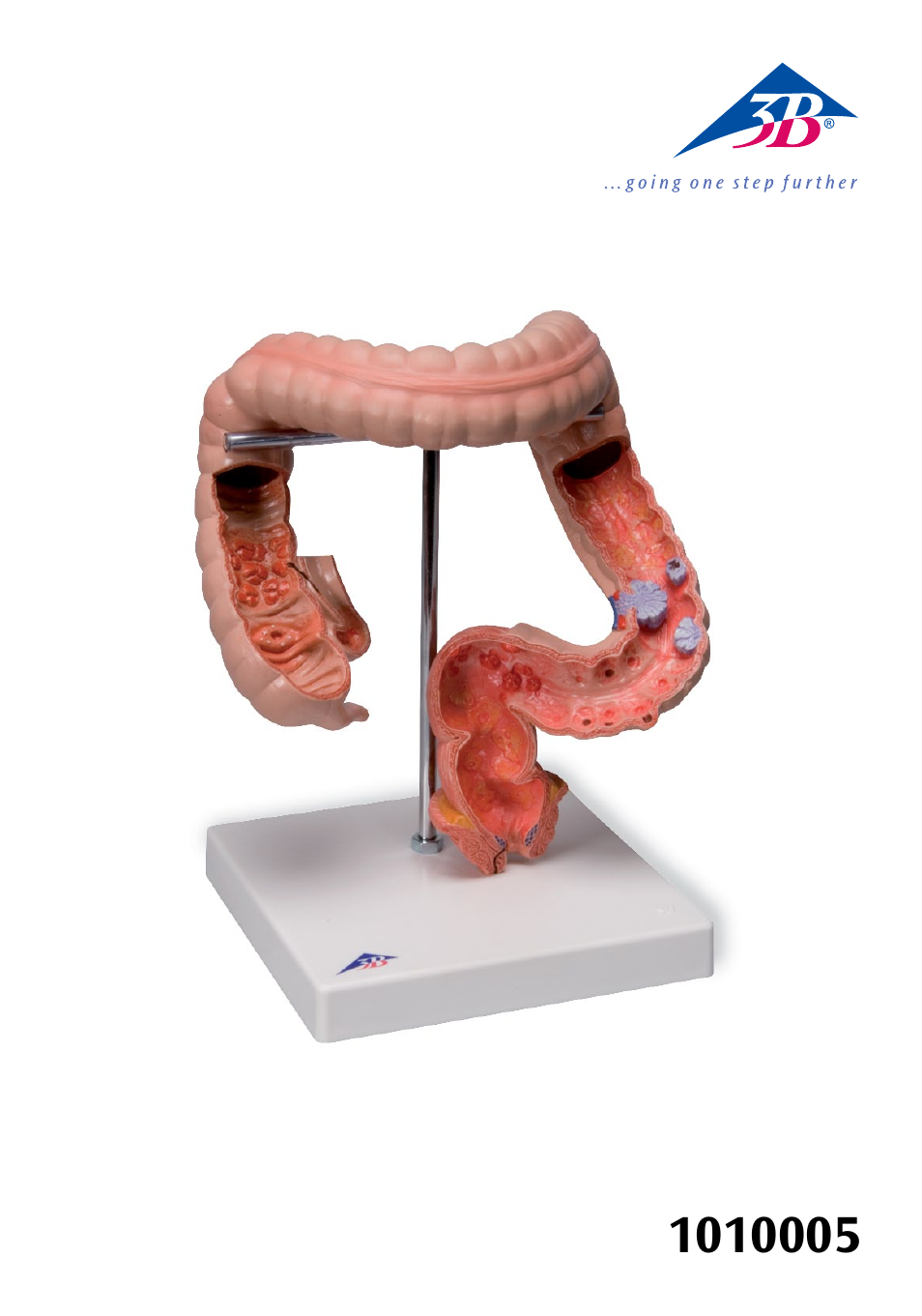 3B Scientific Intestinal diseases User Manual | 11 pages