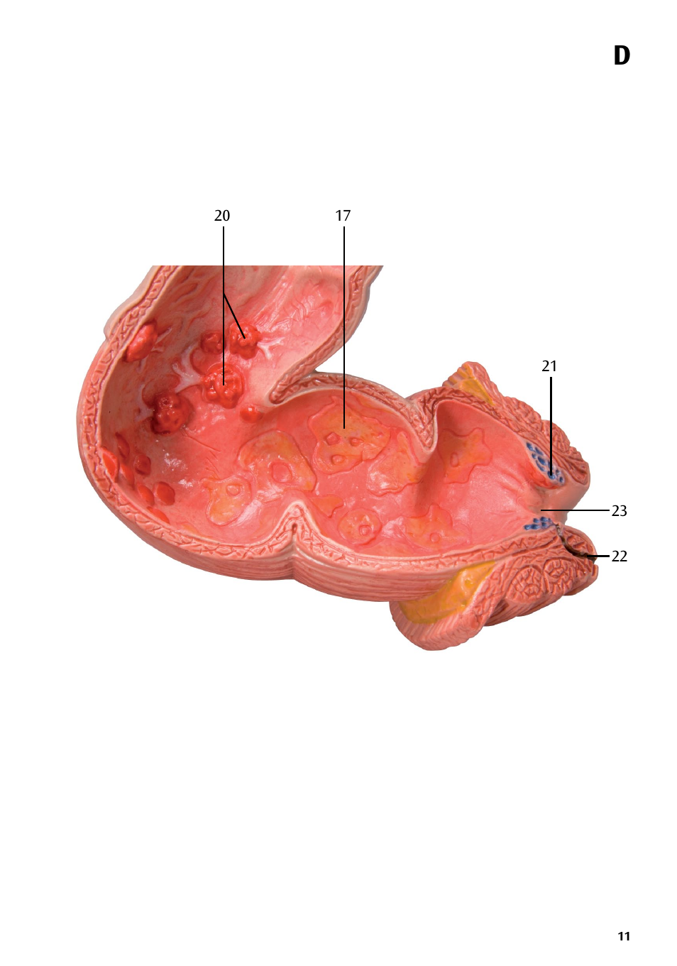 3B Scientific Intestinal diseases User Manual | Page 11 / 11