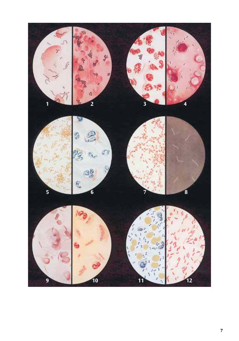 3B Scientific Bacteria Chart User Manual | Page 7 / 16