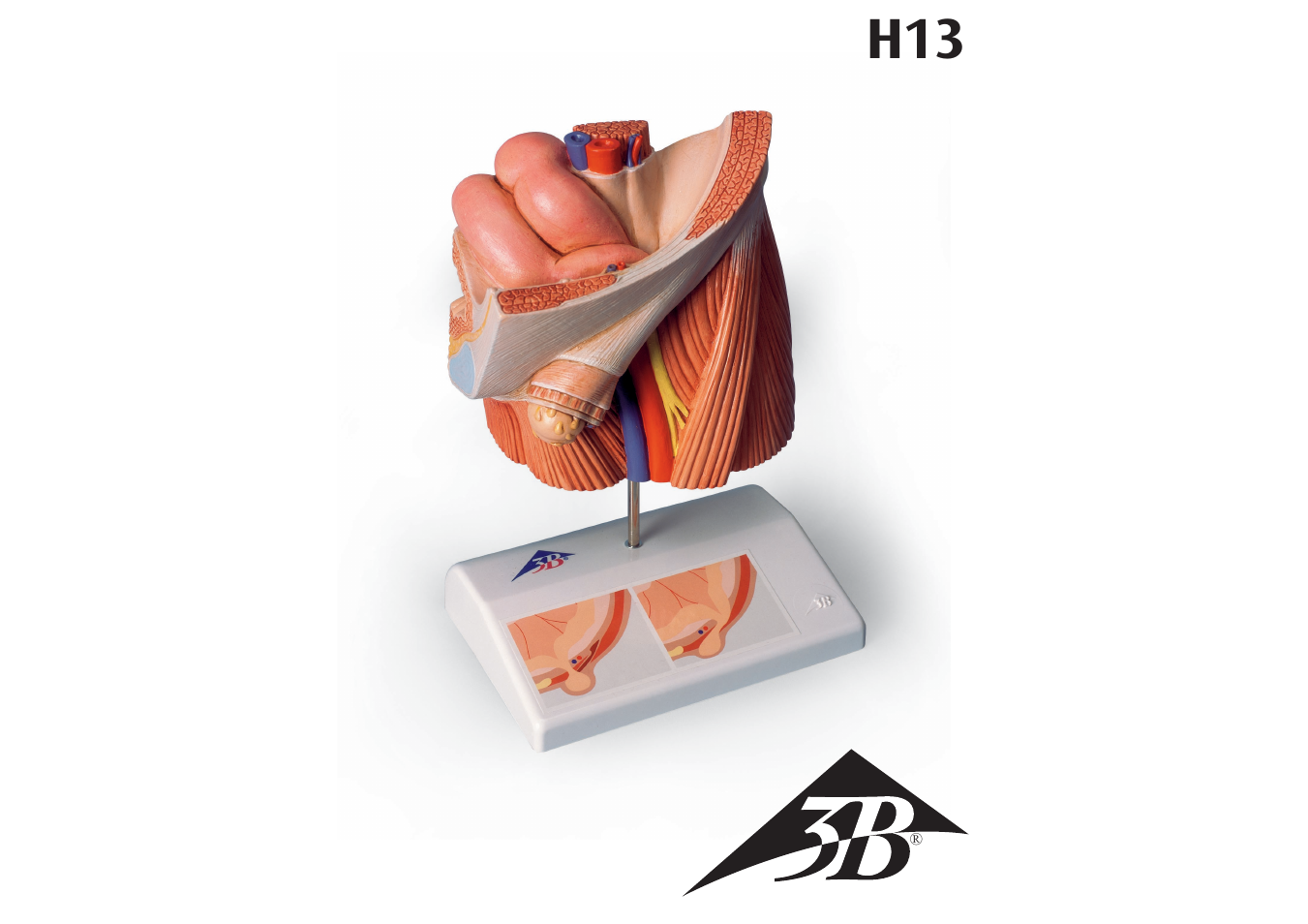 3B Scientific Inguinal Hernia Model User Manual | 7 pages