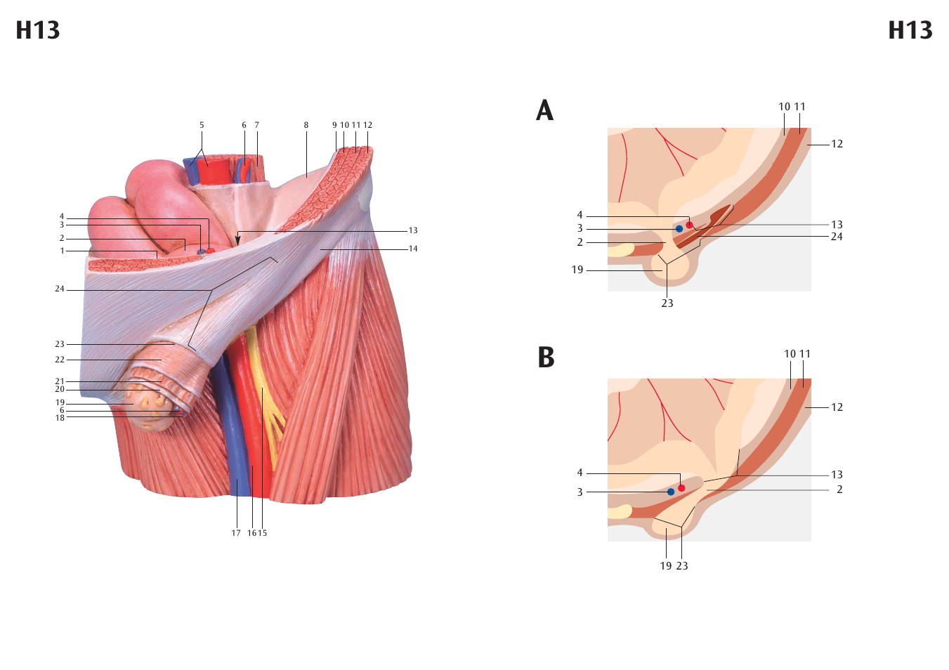3B Scientific Inguinal Hernia Model User Manual | Page 4 / 7