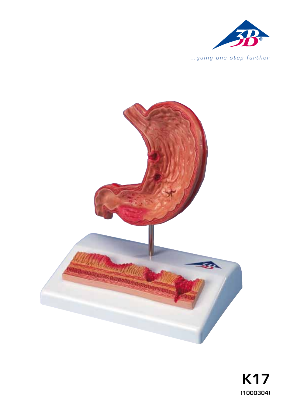 3B Scientific Stomach with Ulcers User Manual | 16 pages