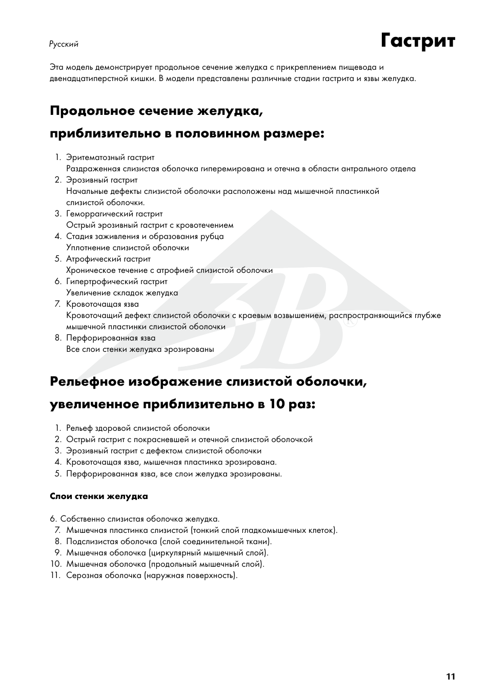 Гастрит | 3B Scientific Stomach with Ulcers User Manual | Page 11 / 16