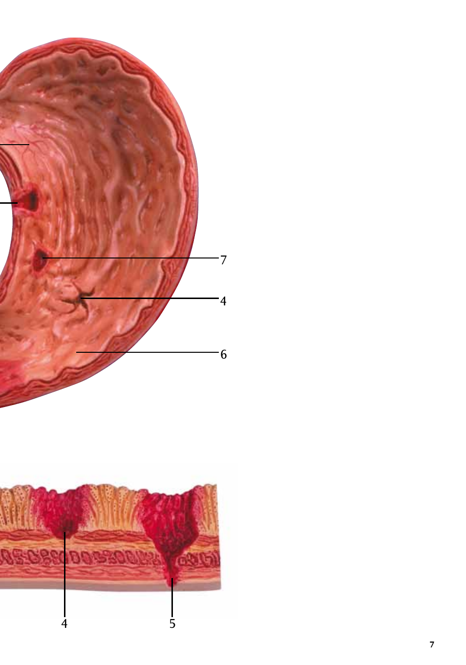 3B Scientific Stomach with Ulcers User Manual | Page 7 / 16