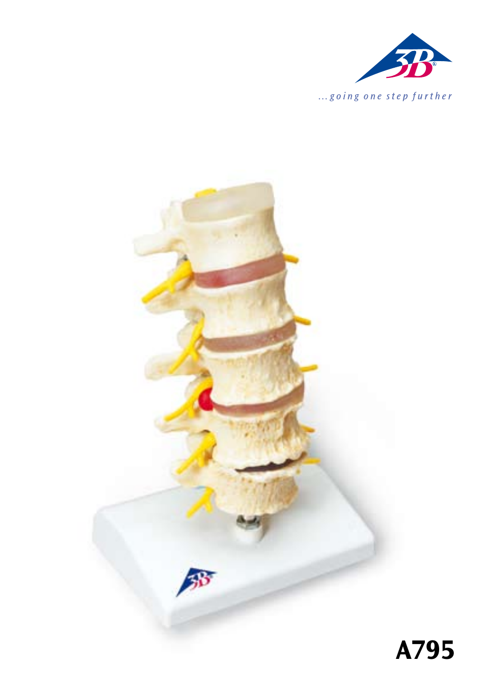 3B Scientific Stages of disc prolapse and vertebral degeneration User Manual | 18 pages