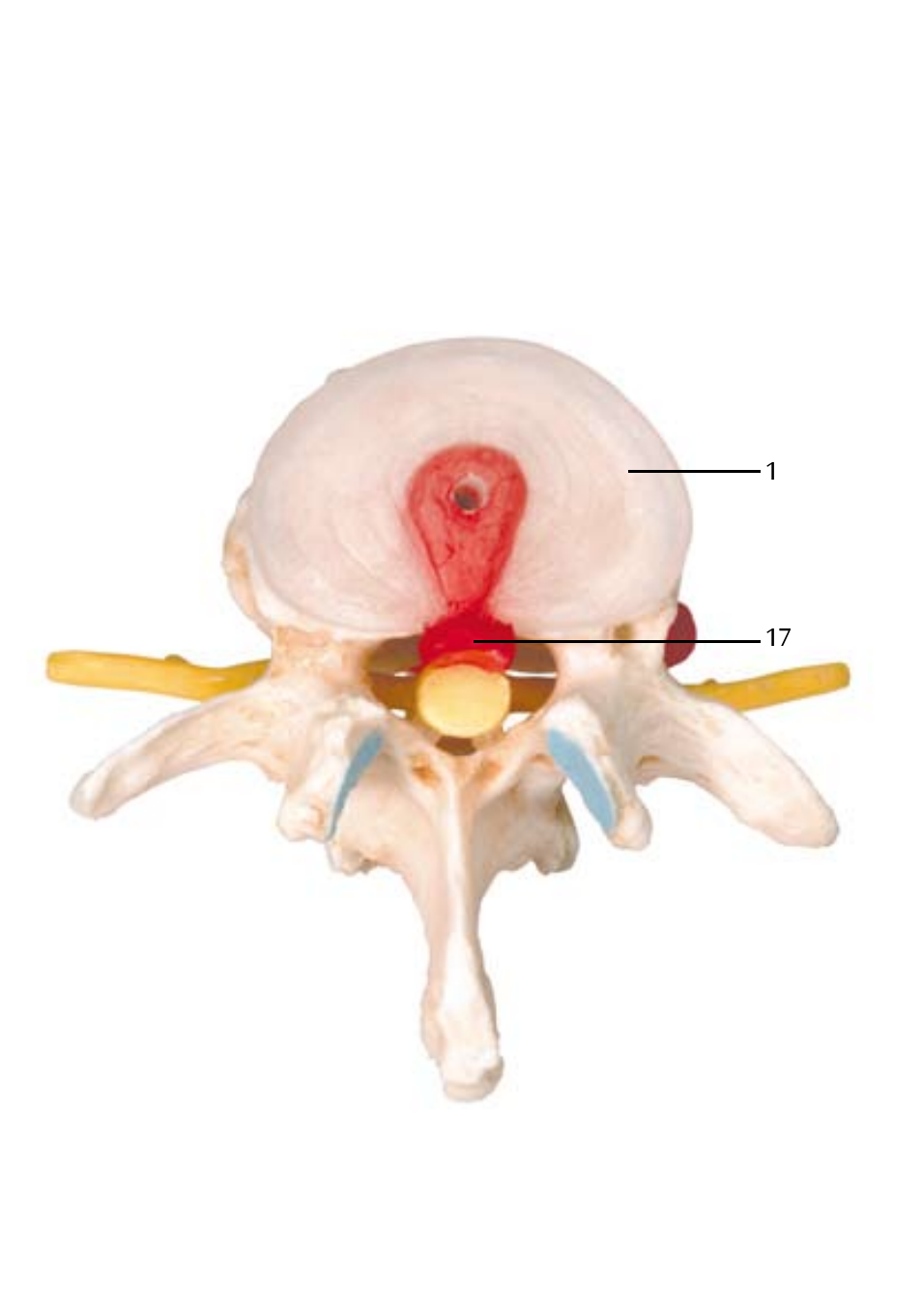 3B Scientific Stages of disc prolapse and vertebral degeneration User Manual | Page 12 / 18