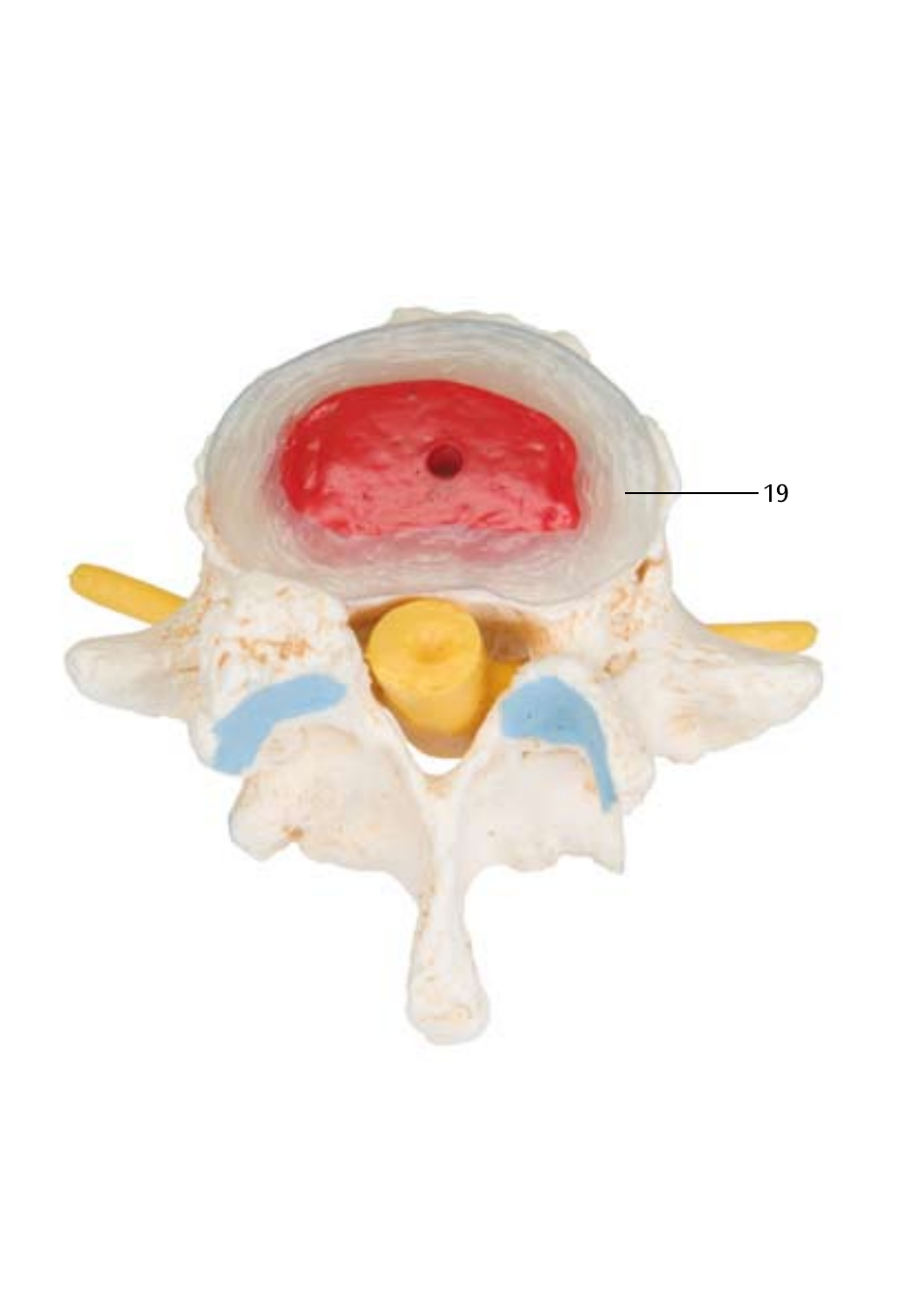 3B Scientific Stages of disc prolapse and vertebral degeneration User Manual | Page 14 / 18