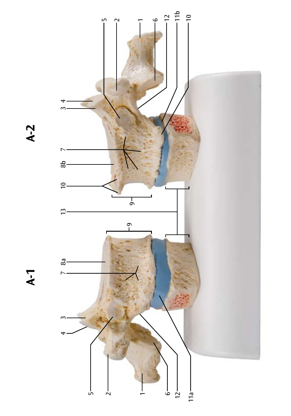 A-2 a-1 | 3B Scientific Osteoporosis Model User Manual | Page 7 / 15