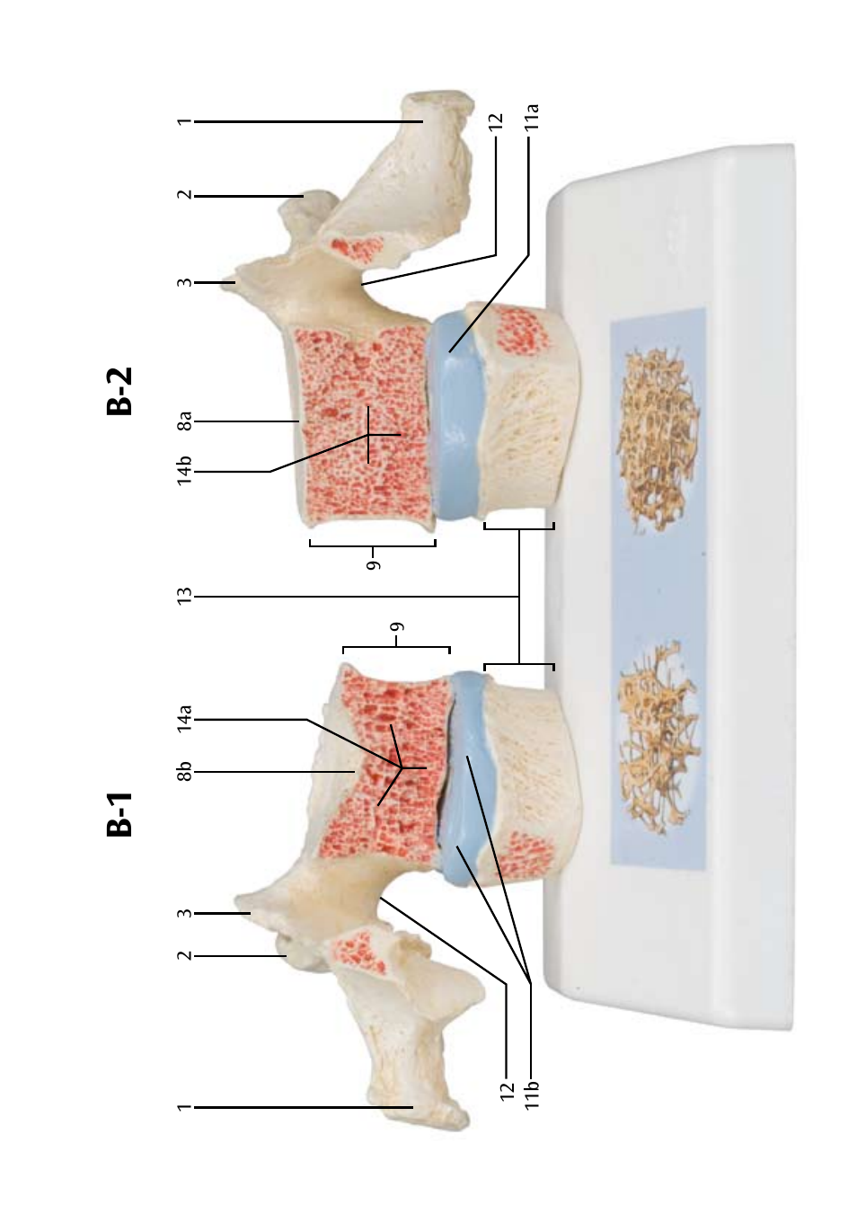 B-2 b-1 | 3B Scientific Osteoporosis Model User Manual | Page 8 / 15
