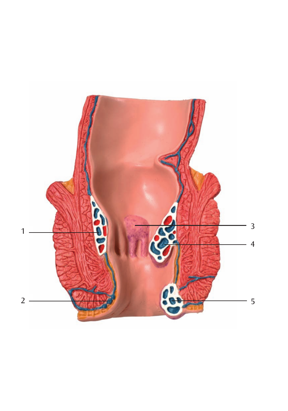 3B Scientific Hemorrhoid Model User Manual | Page 6 / 12