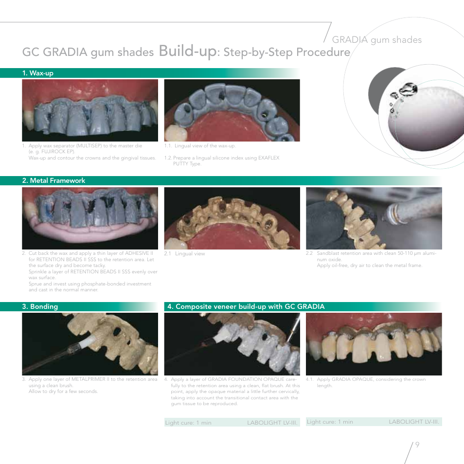 Build-up, Gc gradia gum shades, Step-by-step procedure | Gradia gum shades | GC EUROPE GRADIA gum shades User Manual | Page 7 / 14