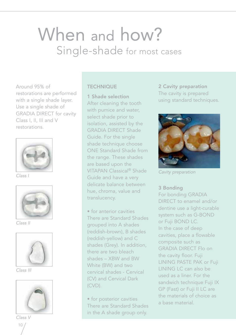 When, Single-shade, For most cases | GC EUROPE GRADIA Direct (X) User Manual | Page 10 / 24