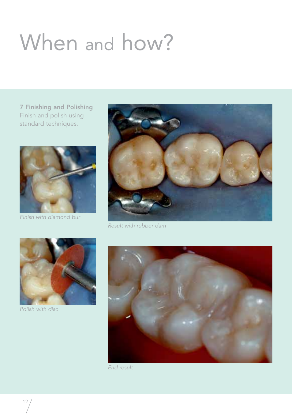 When | GC EUROPE GRADIA Direct (X) User Manual | Page 12 / 24
