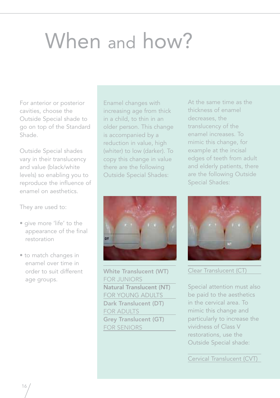 When | GC EUROPE GRADIA Direct (X) User Manual | Page 16 / 24