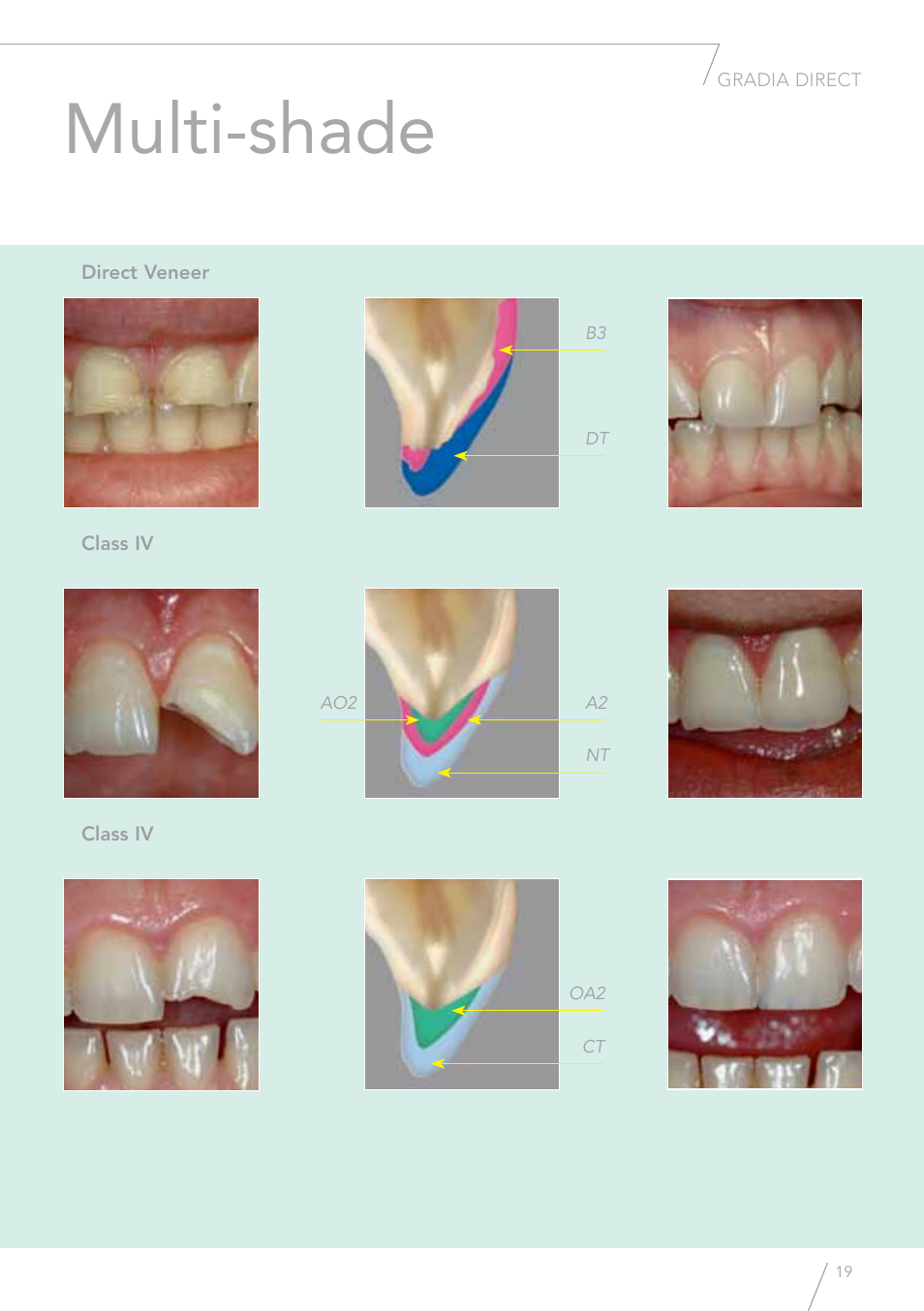 Multi-shade | GC EUROPE GRADIA Direct (X) User Manual | Page 19 / 24