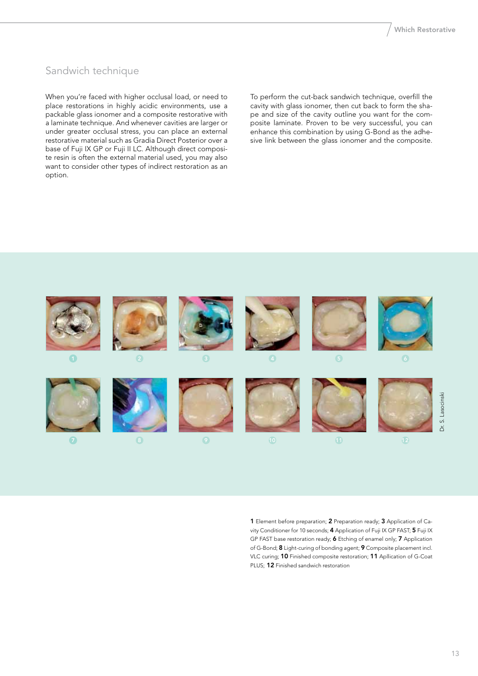 Sandwich technique | GC EUROPE Fuji VIII GP User Manual | Page 13 / 16