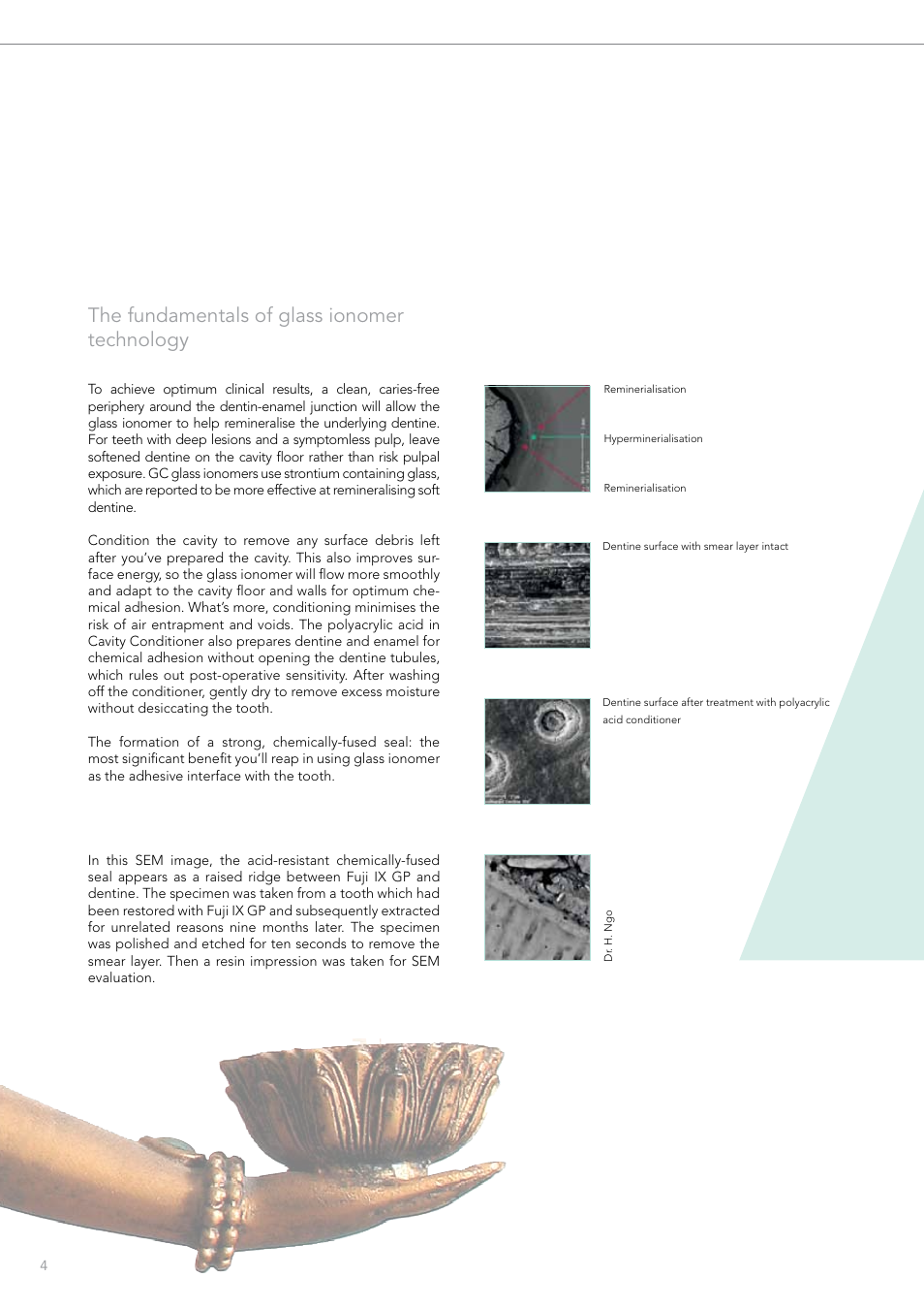 The fundamentals of glass ionomer technology | GC EUROPE Fuji VIII GP User Manual | Page 4 / 16