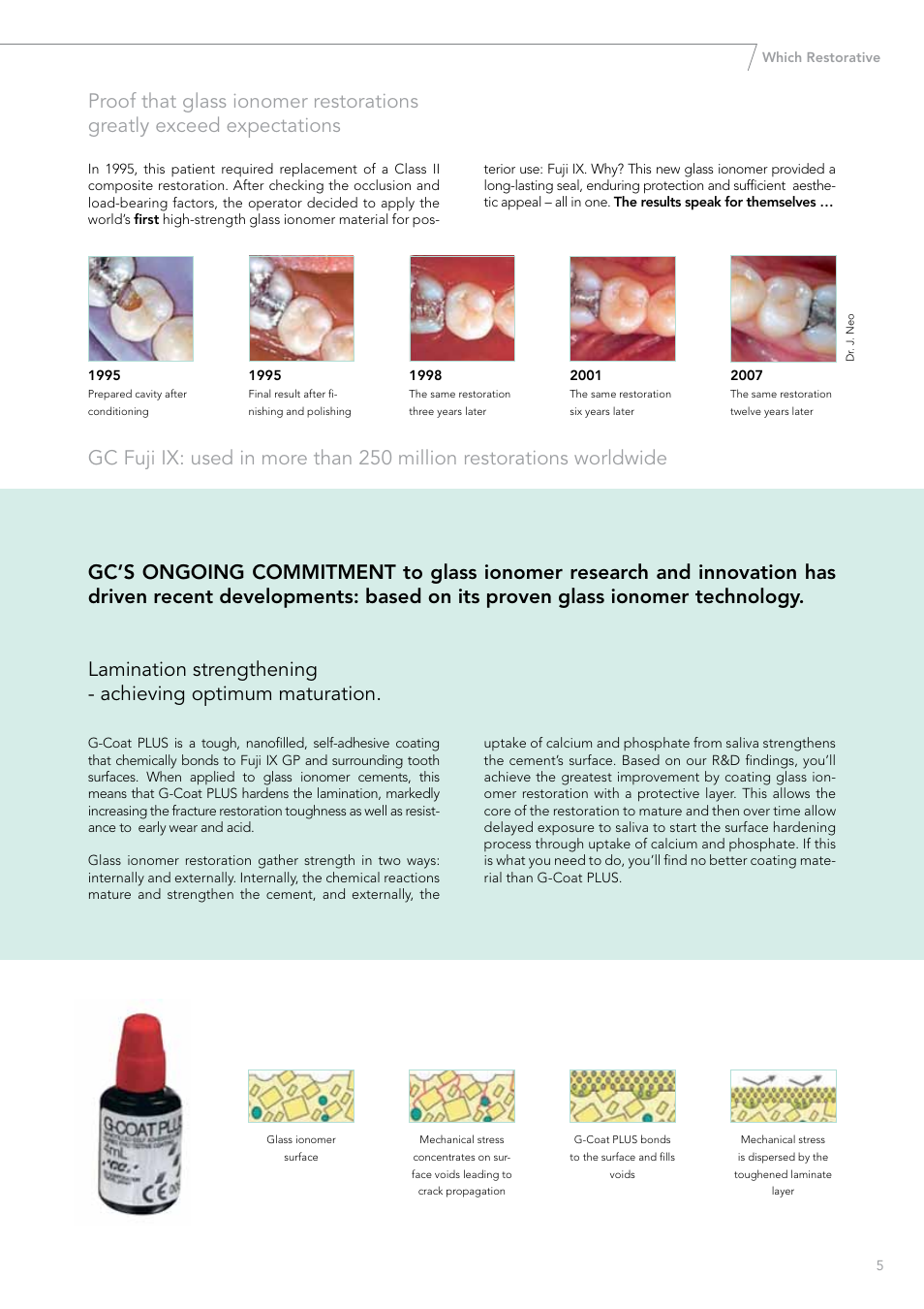 GC EUROPE Fuji VIII GP User Manual | Page 5 / 16