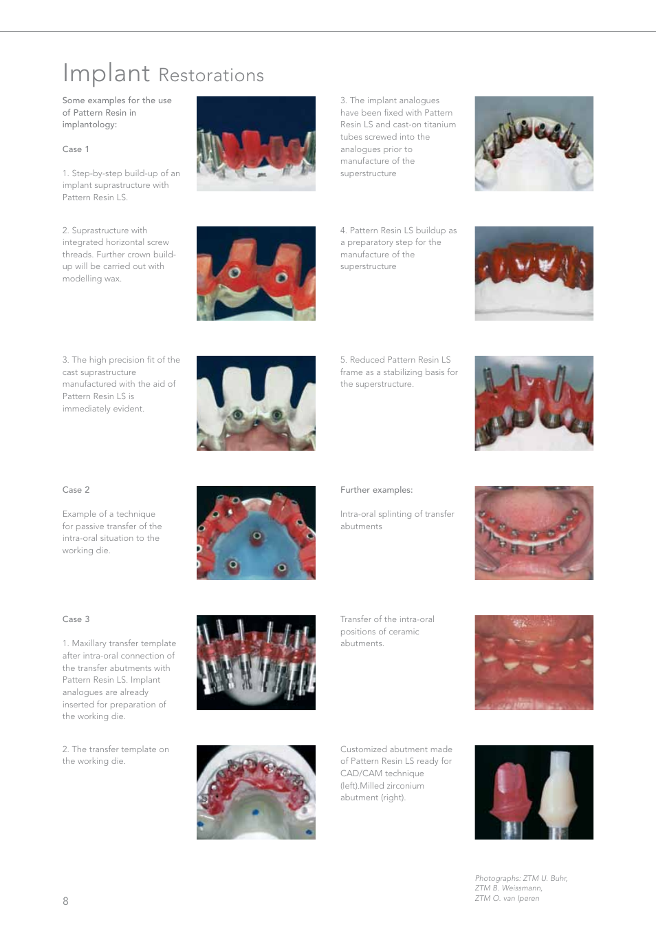 Implant, Restorations | GC EUROPE Pattern Resin LS User Manual | Page 8 / 12