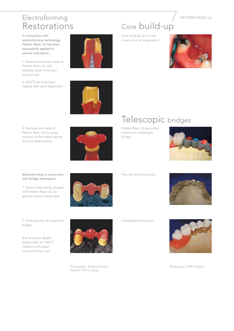 Restorations, Build-up telescopic, Electroforming | Core, Bridges | GC EUROPE Pattern Resin LS User Manual | Page 9 / 12
