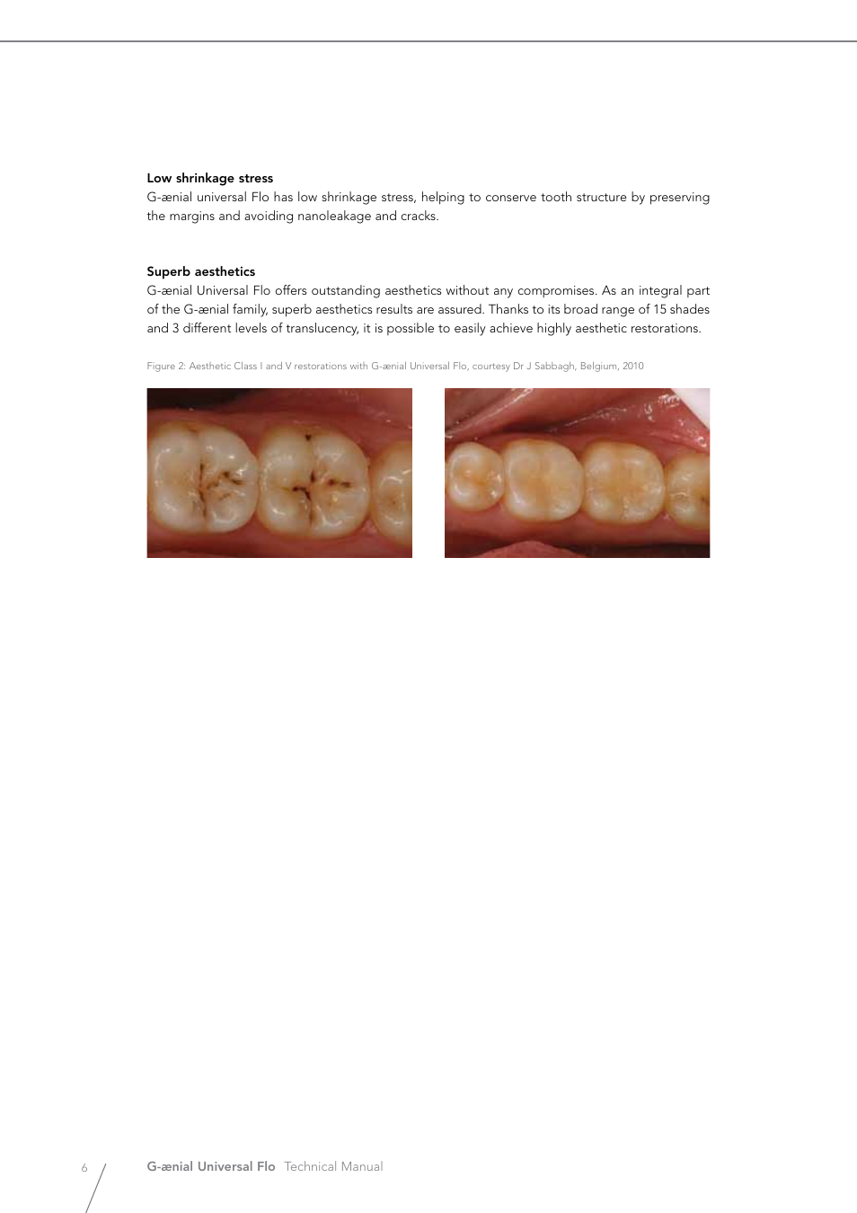 GC EUROPE G-aenial Universal Flo User Manual | Page 6 / 20