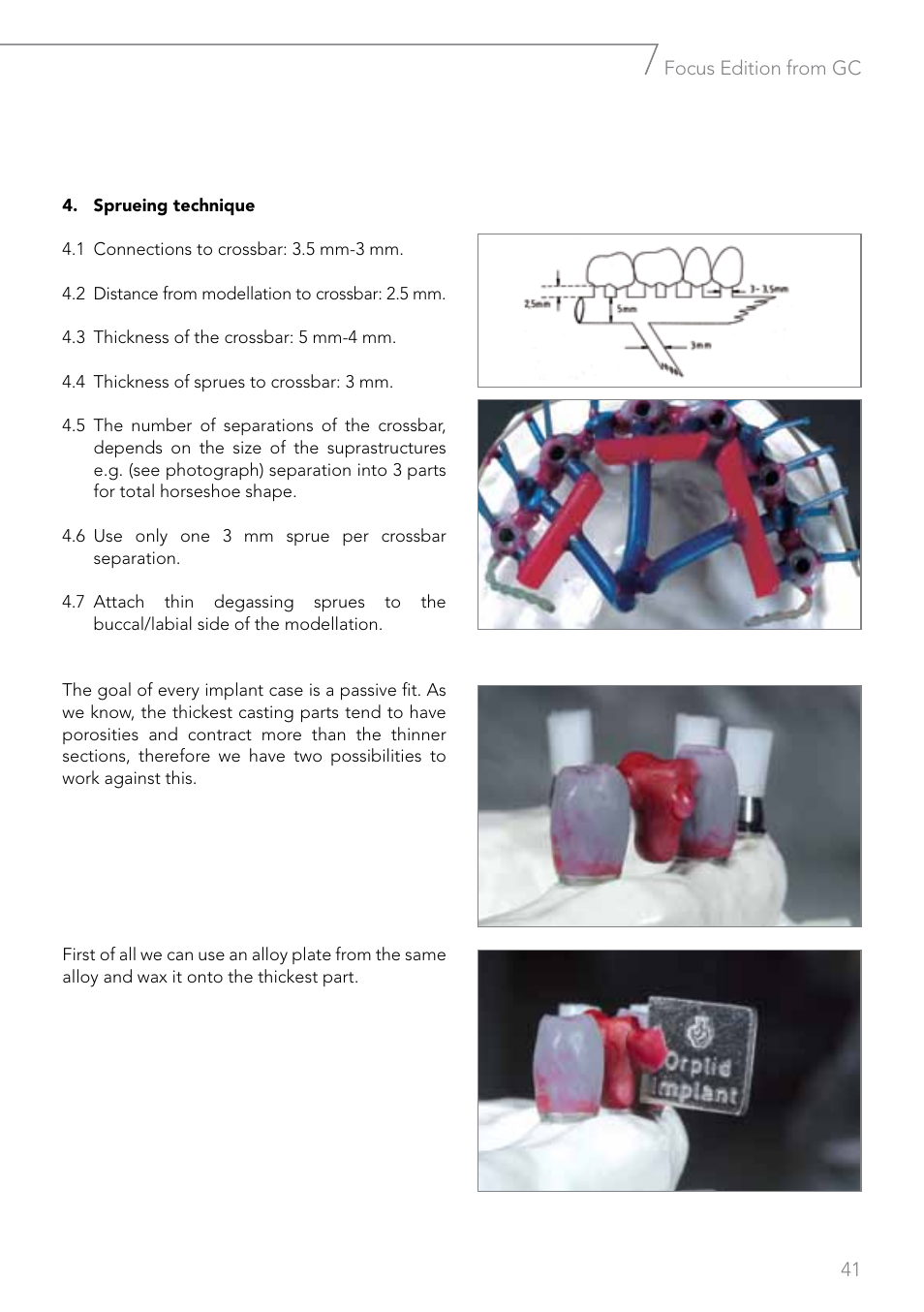 GC EUROPE Fujivest Super User Manual | Page 41 / 68