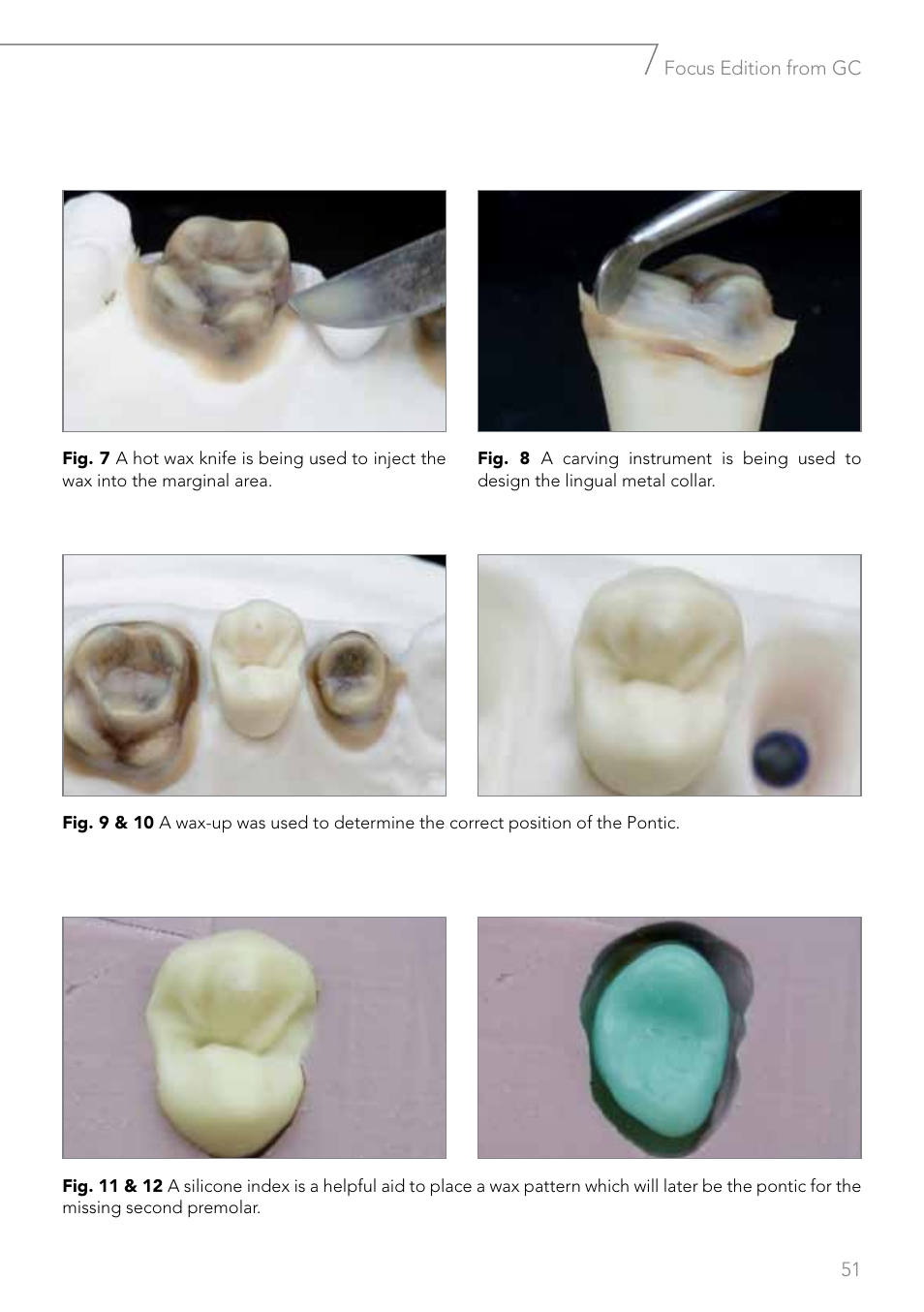 GC EUROPE Fujivest Super User Manual | Page 51 / 68