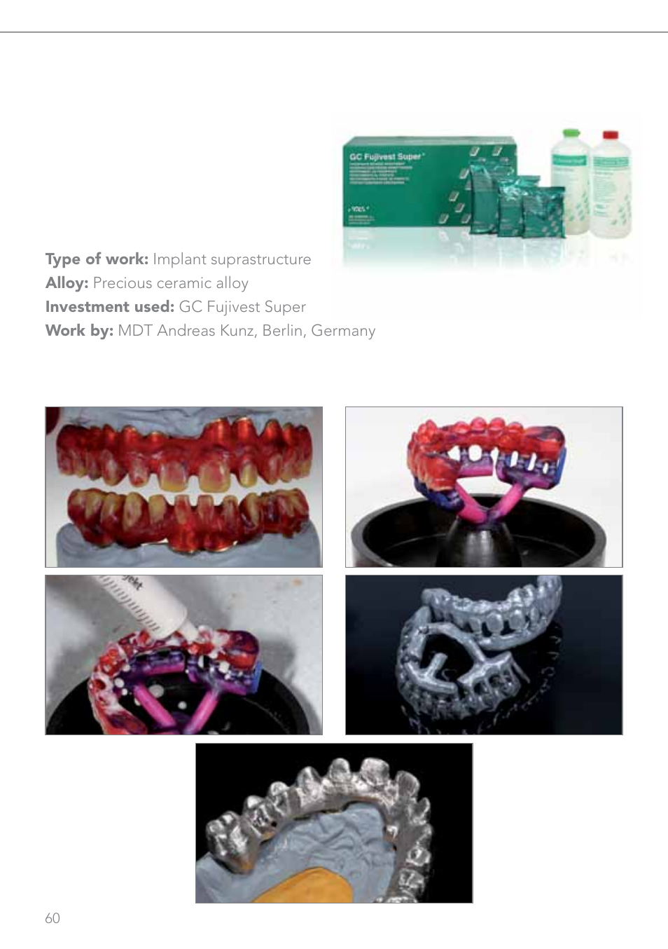 GC EUROPE Fujivest Super User Manual | Page 60 / 68