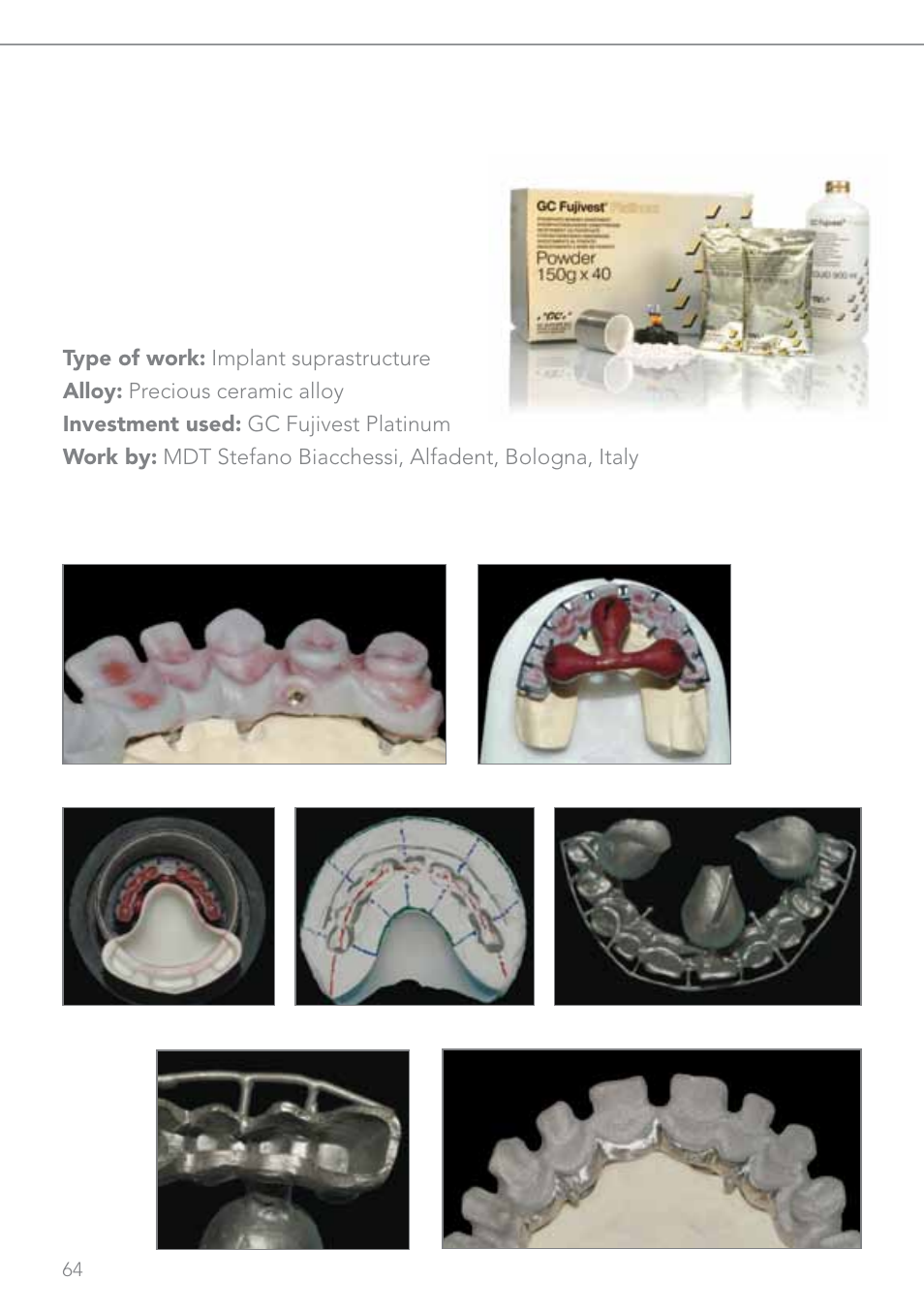 GC EUROPE Fujivest Super User Manual | Page 64 / 68