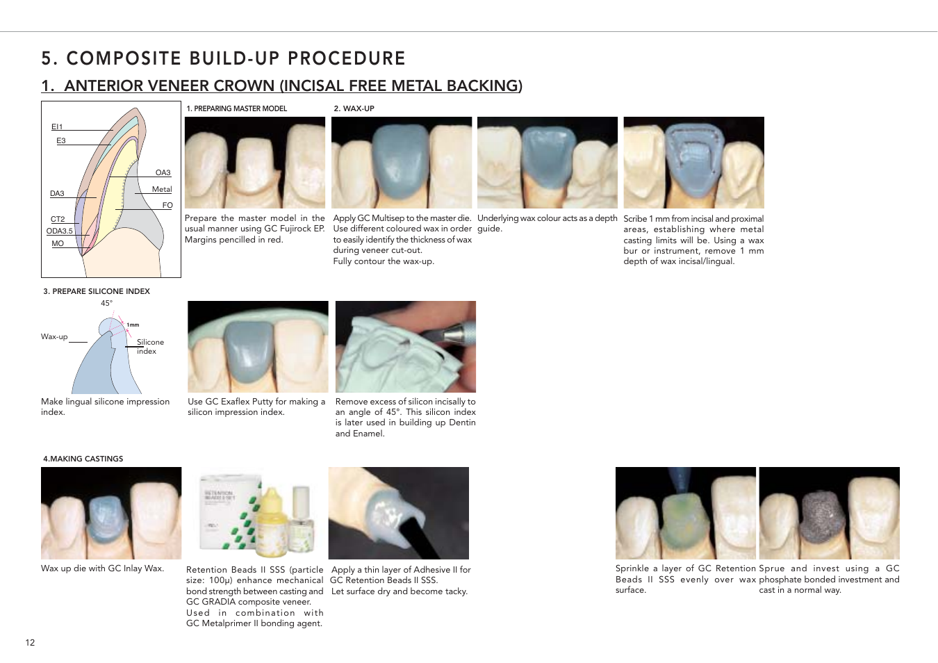 Composite build-up procedure, Anterior veneer crown (incisal free metal backing) | GC EUROPE GRADIA User Manual | Page 14 / 36